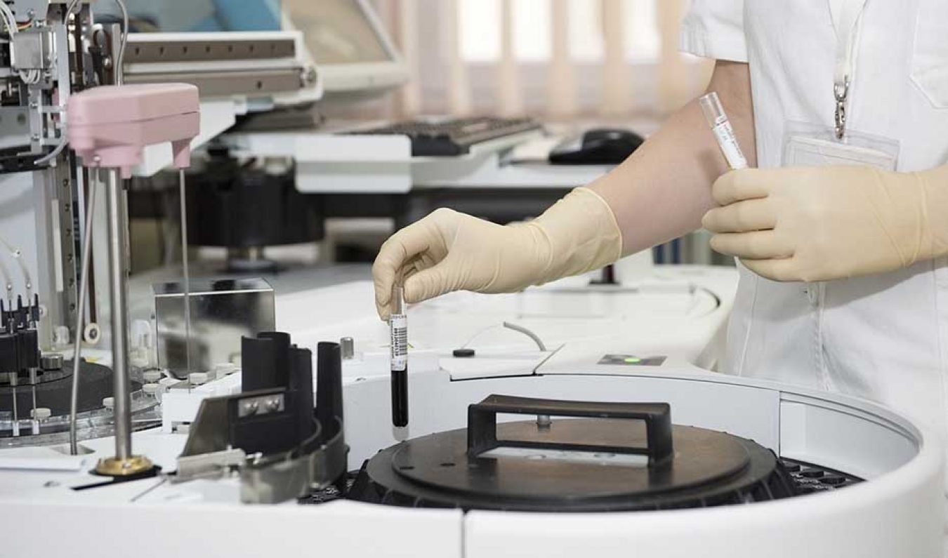 Andalucía participa en una investigación para mejorar la detección del cáncer antes de los primeros síntomas